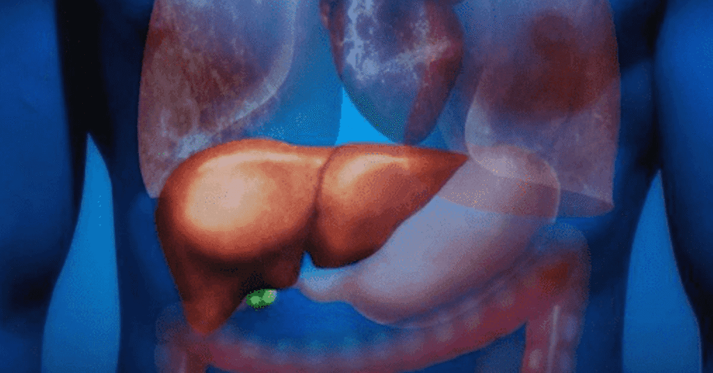 How to Check for Fatty Liver at Home: Tips from a Harvard-Trained Gastroenterologist