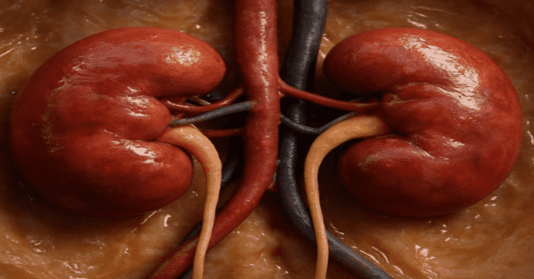 5 Natural Supplements to Reduce Creatinine Levels and Boost Kidney Health