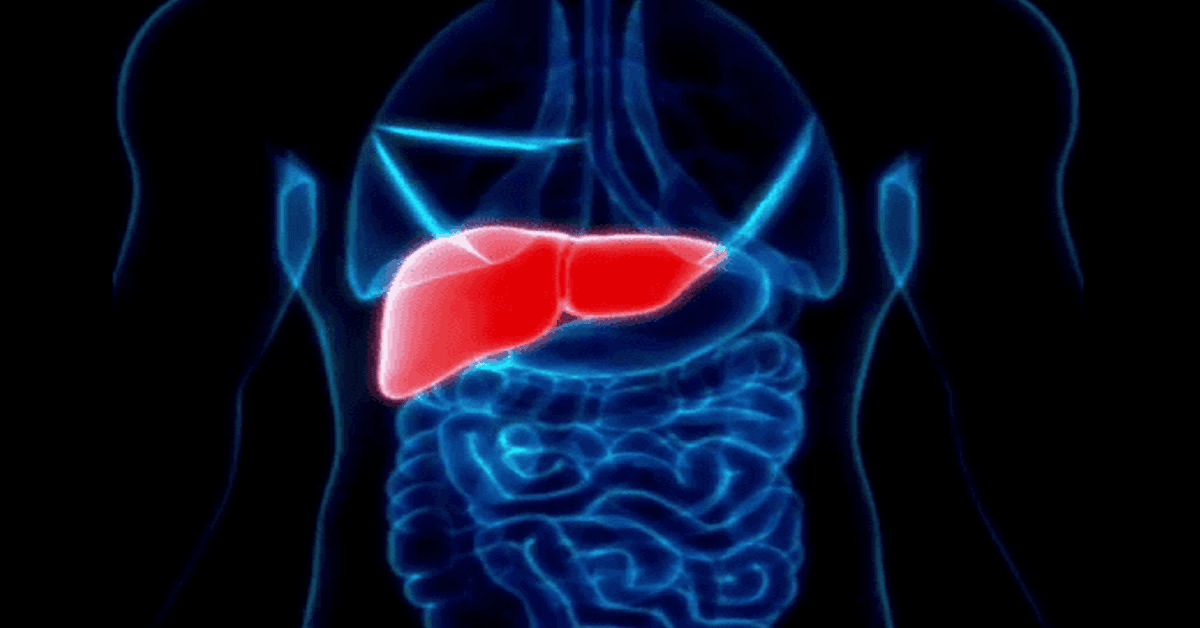 How to Check for Fatty Liver at Home: Tips from a Harvard-Trained Gastroenterologist